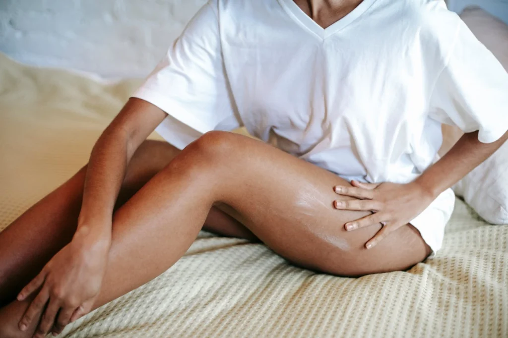 Mulher está passando hidratante em suas pernas - é importante hidratar normalmente após aplicação de ultrassom