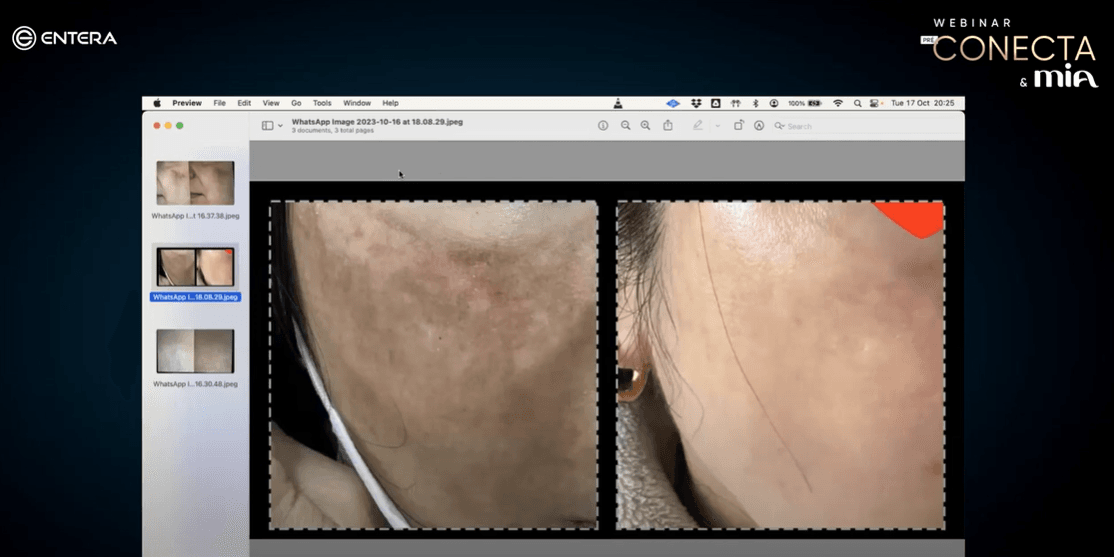 Webinar: Pré-Conecta e MIA