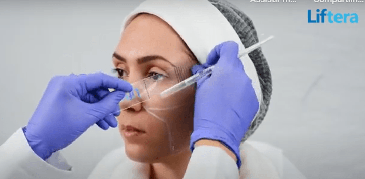 FACE STANDART - MARCAÇÃO