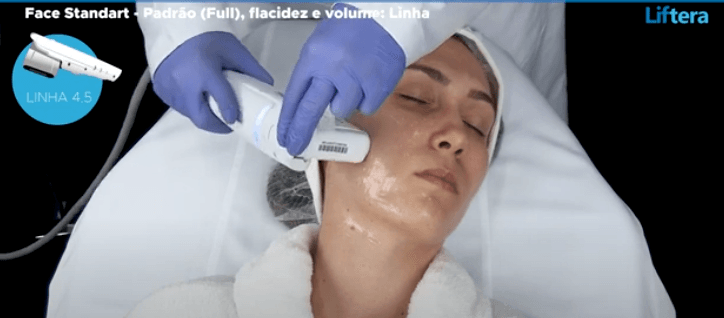 FACE STANDART - PROTOCOLO