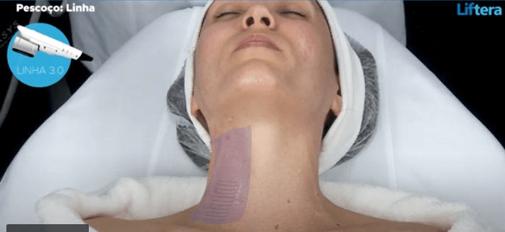 PESCOÇO - PROTOCOLO